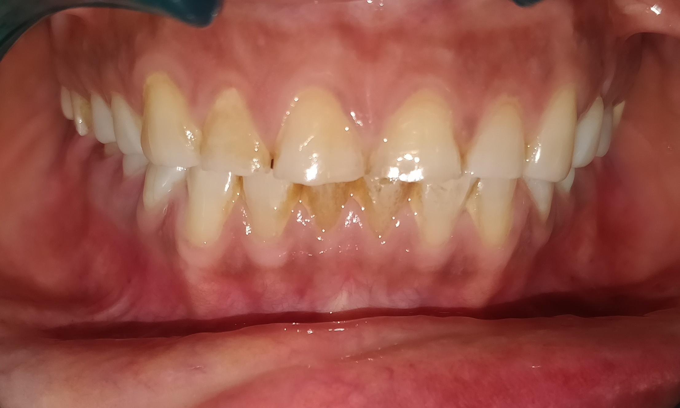 http://dentalexcellence.co.in/wp-content/uploads/2019/11/Pt-1-Pre-4-1.jpg