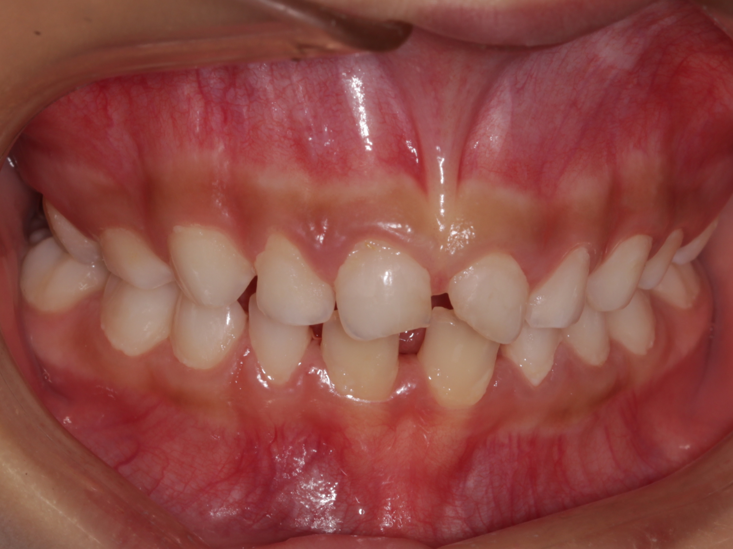 http://dentalexcellence.co.in/wp-content/uploads/2019/11/Pt-1-post-3.jpg