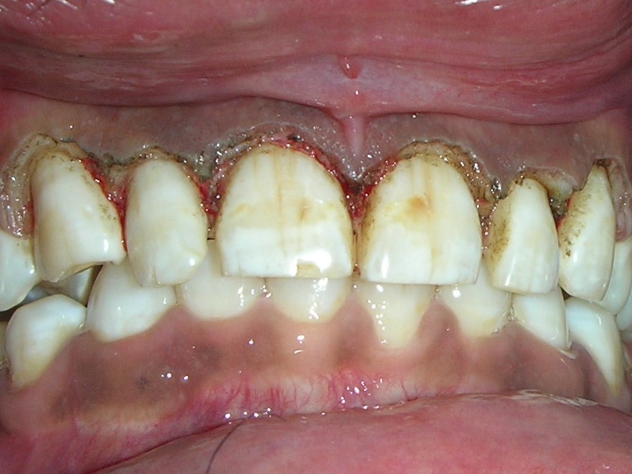 http://dentalexcellence.co.in/wp-content/uploads/2019/11/Pt-2-Post-2.jpg