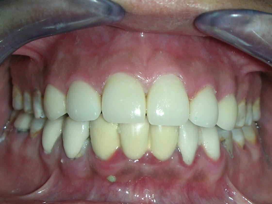 http://dentalexcellence.co.in/wp-content/uploads/2019/11/Pt-3-Post-1.jpg