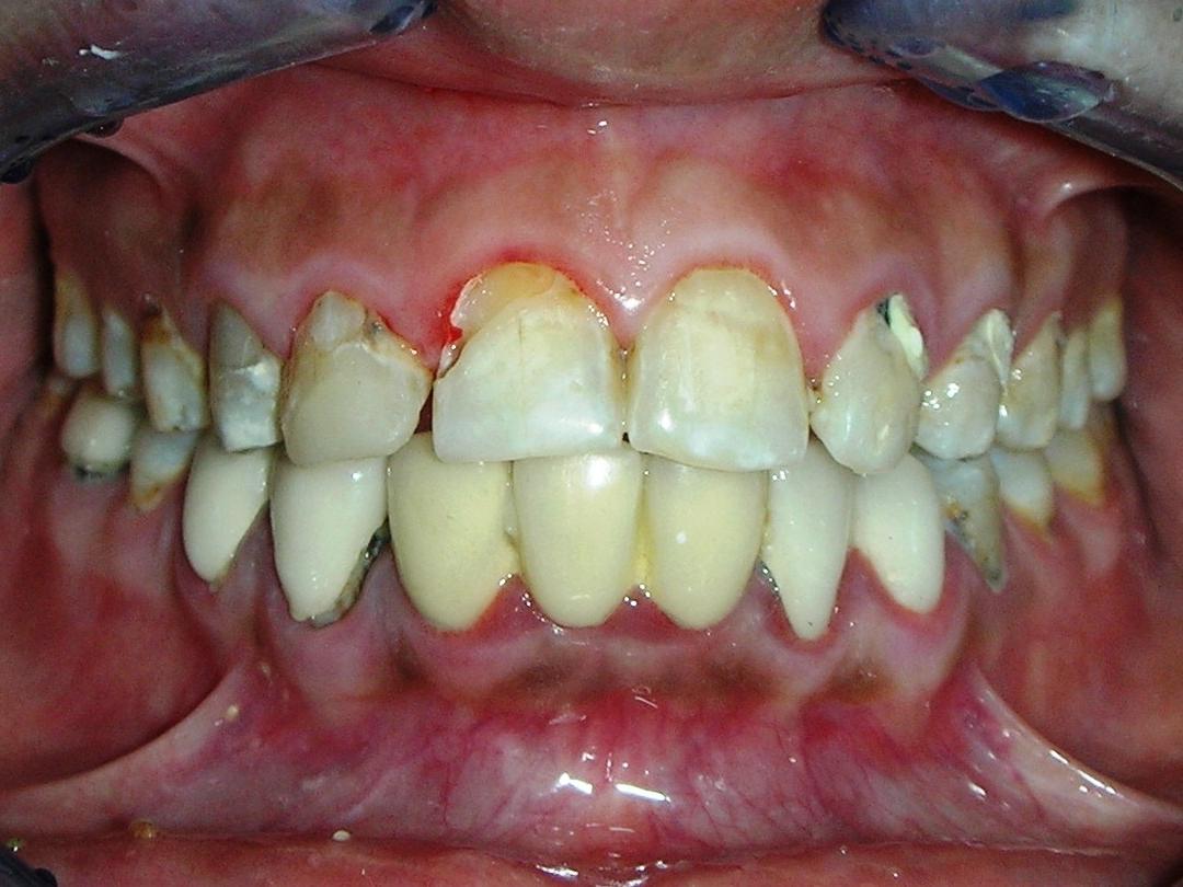 http://dentalexcellence.co.in/wp-content/uploads/2019/11/Pt-3-Pre.jpg