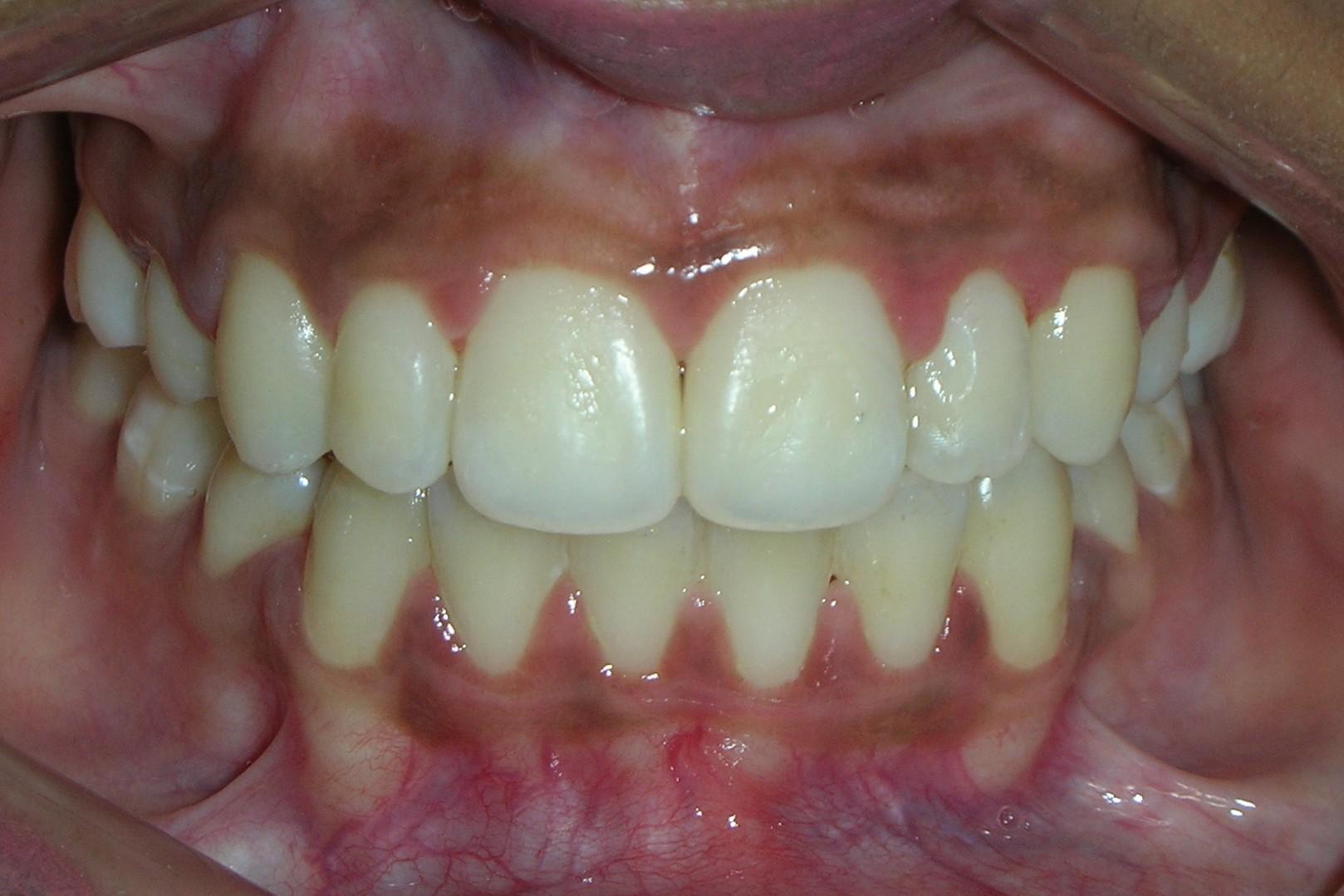 http://dentalexcellence.co.in/wp-content/uploads/2019/12/pt-3-2-1.jpg