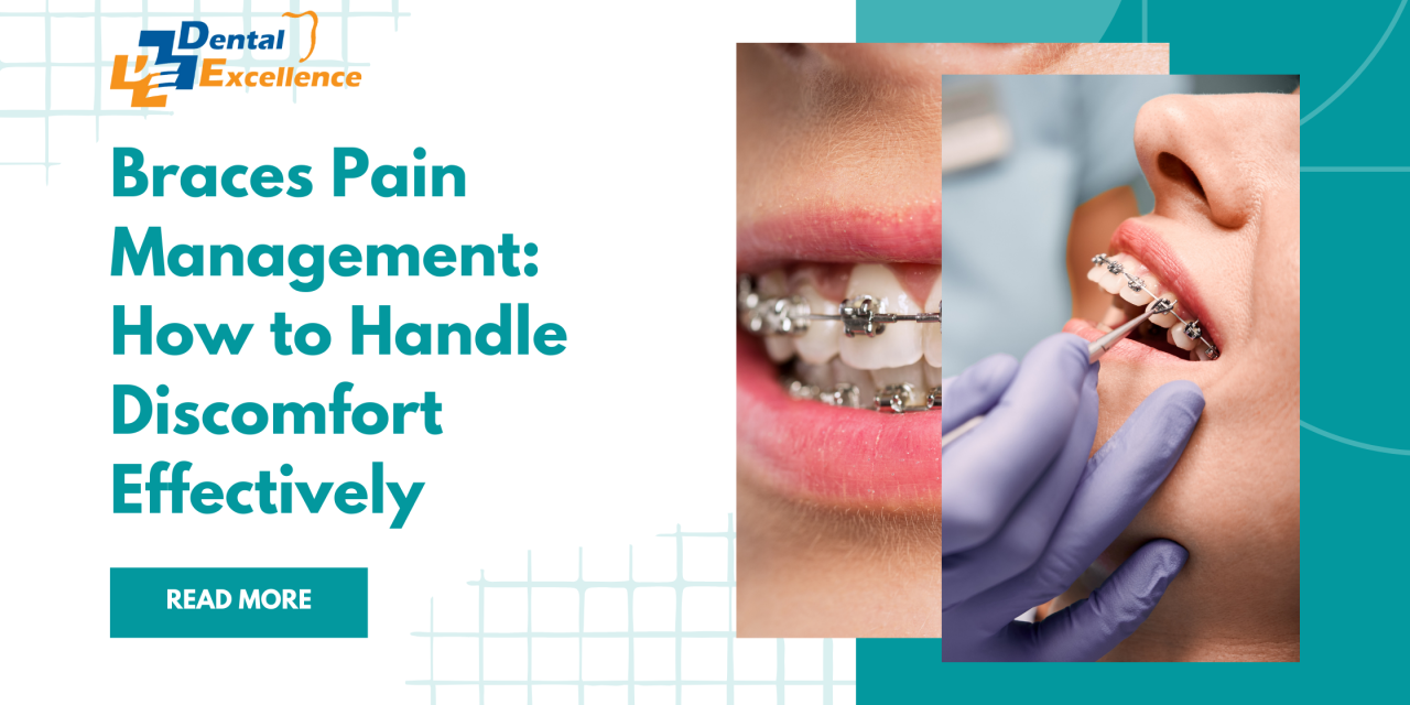 🦷 Braces Pain Management: How to Handle Discomfort Effectively