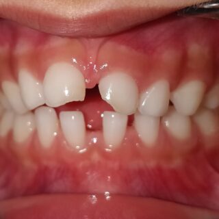 Bad Habits That Can Worsen Your Kid’s Dental Health