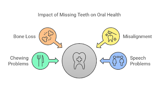 Impact of missing teeth on oral health