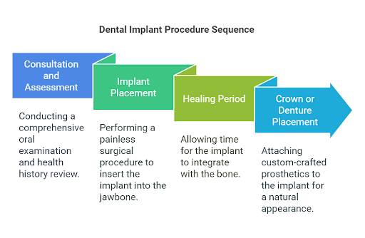 The Implant Procedure at Dental Excellence 